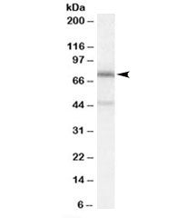 Western blot testing of A431 cell lysate with NO66 antibody at 0.3ug/ml. Predicted molecular weight: