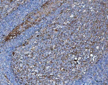 B7-H3 Antibody / CD276