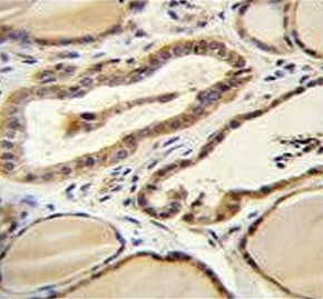 IHC testing of FFPE human thyroid tissue with Retinal guanylyl cyclase 1 antibody. HIER: steam secti