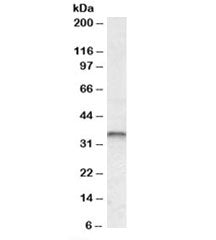 Western blot testing of human breast cancer lysate with JUNB antibody at 0.3ug/ml. Expected molecula
