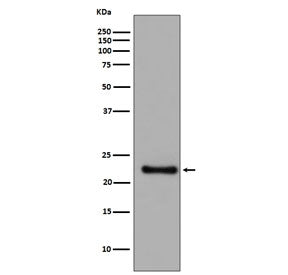 Western blot testing of human SH-SY5Y cell lysate with Glutathione Peroxidase 1 antibody. Predicted 