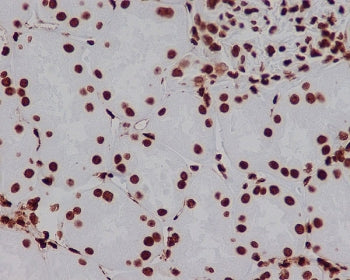 IHC staining of FFPE human kidney tissue with HMGB1 antibody. HIER: boil tissue sections in pH6, 10m
