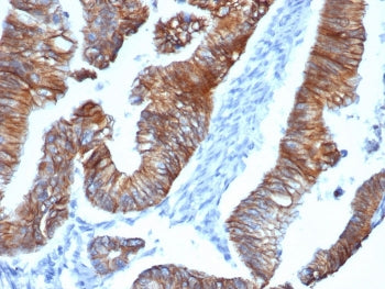 IHC staining of FFPE human colon tissue with recombinant Delta 1 Catenin antibody (clone CTNND1/4383