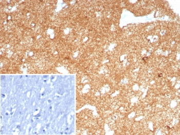 IHC staining of FFPE human brain tissue with recombinant A2MR antibody (clone LRP1/8771R) Inset: PBS