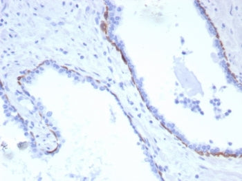 KRT17 Antibody / Cytokeratin 17