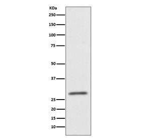 Western blot testing of HUVEC cell lysate with CD99 antibody. Predicted molecular weight: 16-32 kDa 