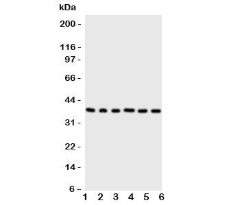 Western blot testing of Cdk7 antibody and Lane 1: rat testis; 2: rat ovary; 3: HeLa; 4: MCF-7; 5: A5