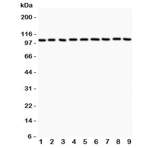 Western blot testing of alpha Catenin antibody and Lane 1: rat liver; 2: (r) lung; 3: (r) heart; 4: 