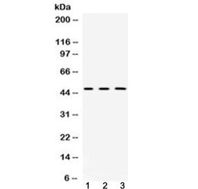 Western blot testing of 1) rat brain, 2) mouse brain and 3) human HeLa lysate with CNPase antibody a