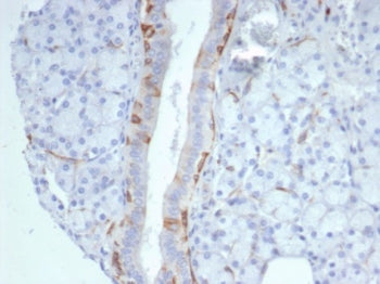 Cytokeratin 14 Antibody / CK14 / KRT14