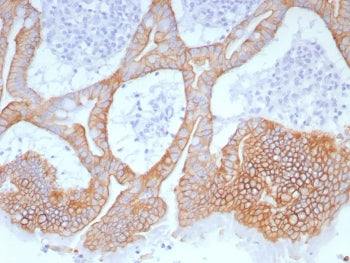 IHC staining of FFPE human colon tissue with Cytokeratin 20 antibody (clone Ks20.8). HIER: boil tiss