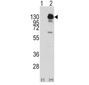 Western blot analysis of PDGFR alpha antibody and 293 cell lysate (2 ug/lane) either nontransfected 