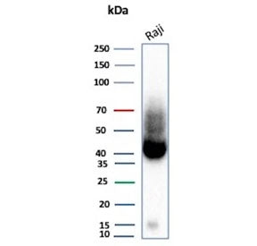 Western blot testing of human Raji tissue lysate with ADPRC1 antibody (clone CD38/9333). Expected mo