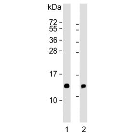 Western blot testing of human 1) placenta and 2) K562 lysate with HBE1 antibody. Predicted molecular