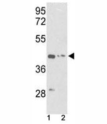 g-Actin Antibody (ACTG1)