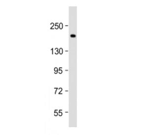 Thrombospondin 1 Antibody