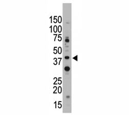 CD33 antibody used in western blot to detect CD33 in Jurkat cell lysate. Predicted molecular weight 