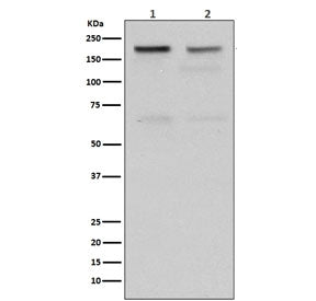Western blot testing of human 1) HeLa and 2) Jurkat cell lysate with TOP2A antibody. Predicted molec