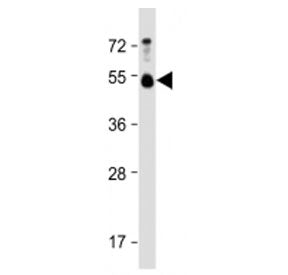 Western blot testing of BMP15 antibody at 1:4000 + human testis lysate. Routinely observed molecular