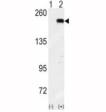 Western blot analysis of GCN2 antibody and 293 cell lysate (2 ug/lane) either nontransfected (Lane 1