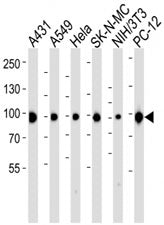 HSP90 Antibody