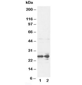 Western blot testing of FGF8 antibody and rat ovary tissue lysate. Predicted molecular weight: ~25 k