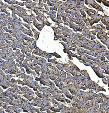 IHC staining of FFPE mouse liver with Egf receptor antibody. HIER: boil tissue sections in pH8 EDTA 