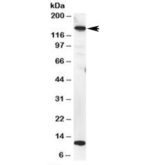 Western blot testing of HeLa lysate with MTR antibody at 2ug/ml. Predicted molecular weight: ~140kDa