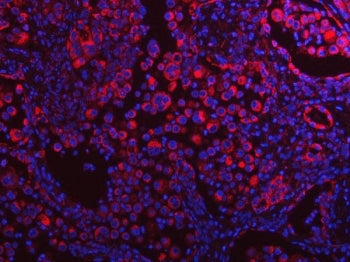 PLEKHA1 Antibody / TAPP-1