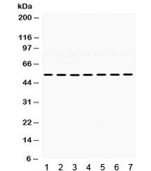 Western blot testing of 1) rat heart, 2) rat brain, 3) rat liver, 4) mouse liver, 5) mouse lung, 6) 