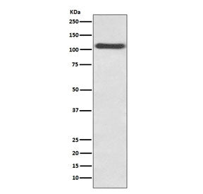 Western blot testing of HUVEC lysate with SELP antibody. Expected molecular weight: 86-140 kDa depen