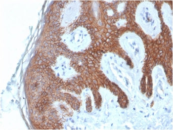 IHC staining of FFPE human skin with Cadherin 1 antibody (clone CDH1/4585). HIER: boil tissue sectio