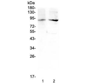 Western blot testing of 1) rat testis and 2) mouse testis lysate with XPB antibody at 0.5ug/ml. Pred