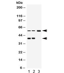 Western blot testing of 1) rat brain, 2) human RH35 and 3) human MCF7 lysate with AHSG antibody. Exp