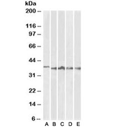 Western blot testing of thymus [A], lymph node [B], tonsil [C], spleen [D] and testis [E] lysates wi