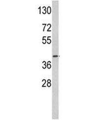 Western blot analysis of ACADM antibody and mouse heart tissue lysate. Predicted molecular weight: ~