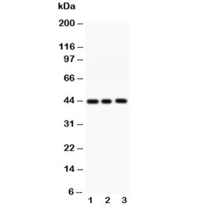 Western blot testing of human 1) MCF-7, 2) HeLa and 3) SW620 lysate with Caspase-1 antibody at 0.5ug