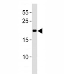 MGMT antibody western blot analysis in Jurkat lysate.