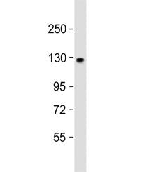 Western blot testing of human brain lysate with ACK1 antibody at 1:1000. Predicted molecular weight 