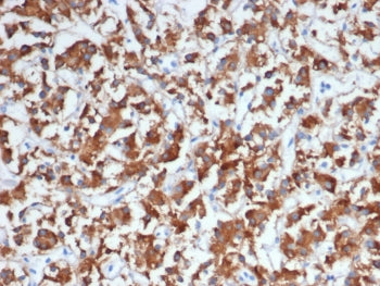 DBH Antibody / Dopamine beta Hydroxylase