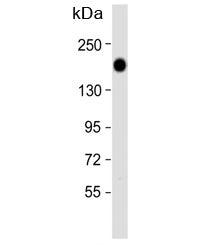 Western blot analysis of Epidermal growth factor receptor antibody and HeLa lysate. Expected molecul