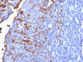 IHC testing of FFPE human tonsil with recombinant IgG antibody (clone IG1707R). Required HIER: boil 