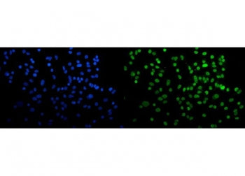 Immunofluorescent staining of FFPE human A549 cells with CBX5 antibody (green) and DAPI nuclear stai
