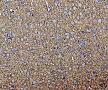 SEPT3 Antibody / Septin 3