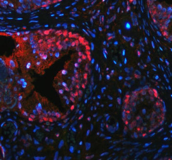 Immunofluorescent staining of FFPE human prostate hyperplasia tissue with p63 antibody (red) and DAP