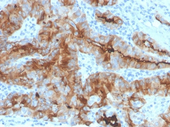 TG Antibody / Thyroglobulin