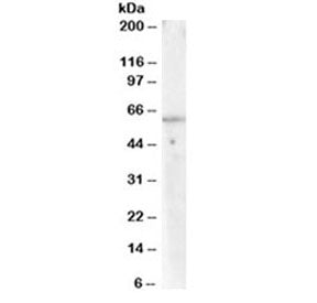 Western blot testing of human lymph node lysate with PPP2R1A antibody at 0.03ug/ml. Predicted molecu