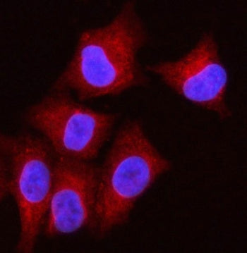 OLAH Antibody / Oleoyl-ACP hydrolase