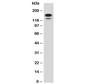 MSH6 Antibody