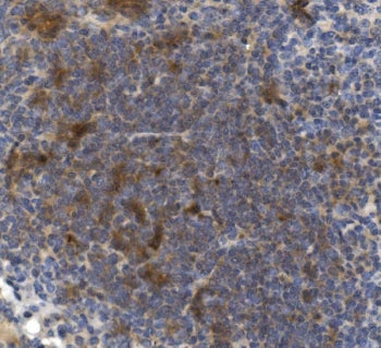 IHC staining of FFPE mouse spleen with Cd73 antibody. HIER: boil tissue sections in pH8 EDTA for 20 